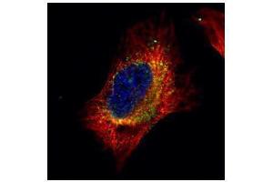 ICC/IF Image Confocal immunofluorescence analysis (Olympus FV10i) of paraformaldehyde-fixed HeLa, using Cofilin 2 (muscle), antibody (Green) at 1:500 dilution. (Cofilin 2 Antikörper)