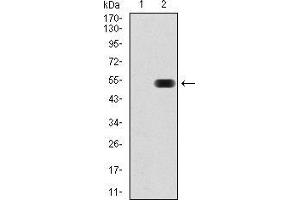 Western Blotting (WB) image for anti-THAP Domain Containing, Apoptosis Associated Protein 1 (THAP1) (AA 1-213) antibody (ABIN5542394)
