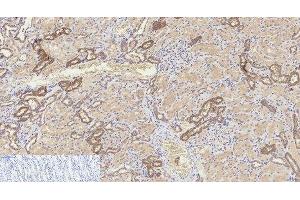 Immunohistochemistry of paraffin-embedded Human kidney tissue using Cleaved-CASP8 (D384) Polyclonal Antibody at dilution of 1:200. (Caspase 8 Antikörper  (Cleaved-Asp384))