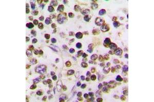Immunohistochemical analysis of Cyclin A1 staining in human testis formalin fixed paraffin embedded tissue section. (Cyclin A1 Antikörper  (C-Term))