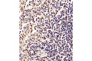 Immunohistochemical analysis of paraffin-embedded H. (beta Actin Antikörper)