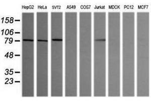 Image no. 7 for anti-SEC14 and Spectrin Domains 1 (SESTD1) antibody (ABIN1501066)