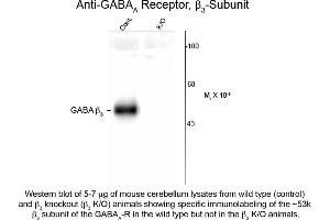 Western blot of GABAA Receptor ß3 Antibody Western Blot of Rabbit anti-GABAA Receptor ß3 Antibody. (GABRB3 Antikörper  (Cytoplasmic Loop))