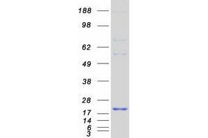 Validation with Western Blot (LDOC1 Protein (Myc-DYKDDDDK Tag))