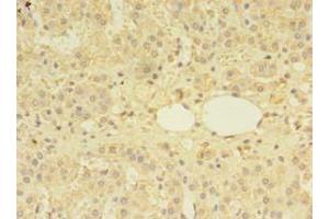 Immunohistochemistry of paraffin-embedded human adrenal gland tissue using ABIN7159585 at dilution of 1:100 (MTR Antikörper  (AA 923-1265))