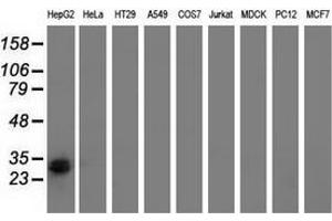 Western blot analysis of extracts (35 µg) from 9 different cell lines by using anti-RASD2 monoclonal antibody. (RASD2 Antikörper)