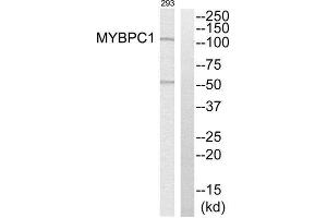 Western Blotting (WB) image for anti-Myosin Binding Protein C, Slow Type (MYBPC1) (Internal Region) antibody (ABIN1851619) (MYBPC1 Antikörper  (Internal Region))