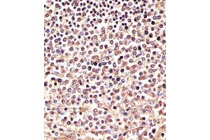 (ABIN6243739 and ABIN6577971) staining PSMB9 in human spleen sections by Immunohistochemistry (IHC-P - paraformaldehyde-fixed, paraffin-embedded sections). (PSMB9 Antikörper  (C-Term))