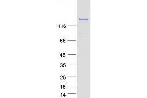 Western Blotting (WB) image for PH Domain and Leucine Rich Repeat Protein Phosphatase 2 (PHLPP2) protein (Myc-DYKDDDDK Tag) (ABIN2728850)