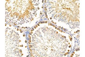 ABIN6256941 and ABIN6274588 at 1/100 staining Rat testis tissue by IHC-P. (beta Arrestin 1 Antikörper  (C-Term))