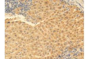 IHC-P analysis of Human Liver Tissue, with DAB staining. (MGP Antikörper  (AA 1-103))