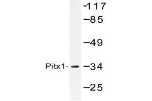 Western blot (WB) analysis of Pitx1 antibody in extracts from Jurkat cells.