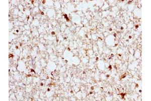 IHC image of ABIN7144757 diluted at 1:300 and staining in paraffin-embedded human brain tissue performed on a Leica BondTM system. (Aspartate beta Hydroxylase Antikörper  (AA 75-270))