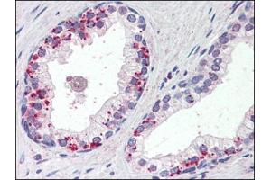 Human Prostate (formalin-fixed, paraffin-embedded) stained with ANXA1at 4 µg/ml followed by biotinylated anti-goat IgG secondary antibody, alkaline phosphatase-streptavidin and chromogen. (Annexin a1 Antikörper  (C-Term))