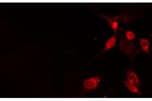 ABIN6272360 staining Hela by IF/ICC. (NFATC2IP Antikörper  (Internal Region))
