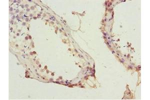 Immunohistochemistry of paraffin-embedded human testis tissue using ABIN7156130 at dilution of 1:100 (KPNA5 Antikörper  (AA 1-240))