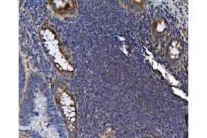 IHC analysis of SEC14L3/TAP2 using anti-SEC14L3/TAP2 antibody (ABIN7601623). (SEC14L3 Antikörper  (AA 4-400))