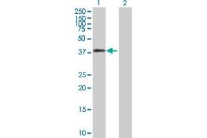 Western Blotting (WB) image for anti-DNA Fragmentation Factor, 45kDa, alpha Polypeptide (DFFA) (AA 1-331) antibody (ABIN514953)