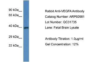 Western Blotting (WB) image for anti-Vascular Endothelial Growth Factor A (VEGFA) (C-Term) antibody (ABIN2788641) (VEGFA Antikörper  (C-Term))