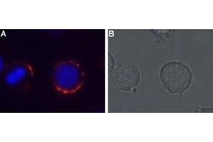 Expression of MC4R in rat pituitary cell line - Cell surface detection of MC4R in live intact GH3 cells with Anti-MC4 Receptor (extracellular) Antibody (ABIN7043324, ABIN7044596 and ABIN7044597), (1:50). (MC4R Antikörper  (Extracellular, N-Term))