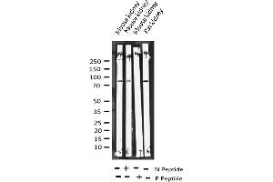 Western blot analysis of Phospho-Tau (Ser422) expression in various lysates (MAPT Antikörper  (pSer422))
