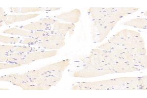 Detection of TAZ in Mouse Skeletal muscle Tissue using Polyclonal Antibody to Tafazzin (TAZ) (TAZ Antikörper  (AA 46-240))