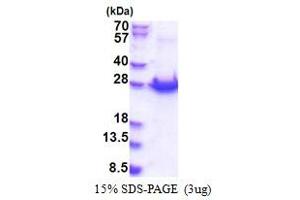 Protein-L-Isoaspartate (D-Aspartate) O-Methyltransferase Domain Containing 1 (PCMTD1) (AA 1-220) protein (His tag)