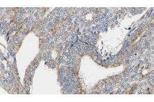 ABIN6276352 at 1/100 staining Human prostate tissue by IHC-P. (TUBA4A Antikörper  (N-Term))