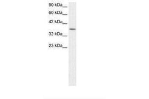 Image no. 1 for anti-Ribosomal Protein S16 (RPS16) (AA 92-139) antibody (ABIN202390)