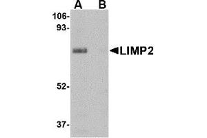 Western Blotting (WB) image for anti-Scavenger Receptor Class B, Member 2 (SCARB2) (Middle Region) antibody (ABIN1030987) (SCARB2 Antikörper  (Middle Region))