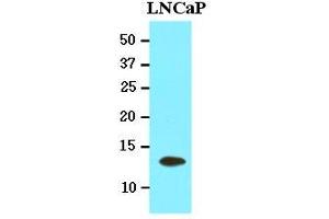 Western Blotting (WB) image for anti-Tubulin Folding Cofactor A (TBCA) (AA 1-108), (N-Term) antibody (ABIN400854) (TBCA Antikörper  (N-Term))