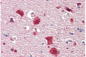 Immunohistochemistry (IHC) image for anti-ELAV (Embryonic Lethal, Abnormal Vision, Drosophila)-Like 2 (Hu Antigen B) (ELAVL2) (AA 11-60) antibody (ABIN2879400)