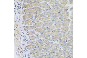Immunohistochemistry of paraffin-embedded mouse stomach using EFHC1 antibody (ABIN5975244) at dilution of 1/100 (40x lens). (EFHC1 Antikörper)