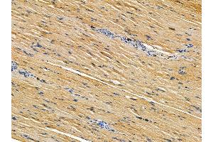 ABIN7095493 and ABIN7099550 at 1/100 staining rat muscle tissue by IHC-P. (Phosphoglucomutase 3 Antikörper)