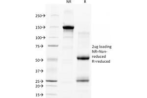 SDS-PAGE Analysis Purified CD28 Mouse Monoclonal Antibody (C28/77). (CD28 Antikörper)