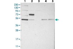 Western blot analysis of Lane 1: RT-4, Lane 2: U-251 MG, Lane 3: Human Plasma, Lane 4: Liver, Lane 5: Tonsil with CDCA7L polyclonal antibody  at 1:250-1:500 dilution. (CDCA7L Antikörper)