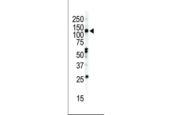 EPH Receptor B2 Antikörper  (C-Term)