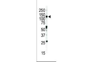 Western blot analysis of anti-EphB2 C-term Pab (ABIN391920 and ABIN2841730) in NCI- cell lysate. (EPH Receptor B2 Antikörper  (C-Term))