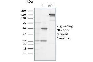 SDS-PAGE Analysis Purified CD284 Mouse Monoclonal Antibody (TLR4/230). (TLR4 Antikörper)