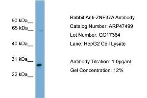 WB Suggested Anti-ZNF37A  Antibody Titration: 0. (ZNF37A Antikörper  (Middle Region))