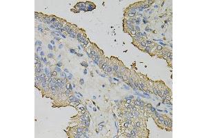 Immunohistochemistry of paraffin-embedded human prostate using AZGP1 Antibody (ABIN1876553) at dilution of 1:100 (40x lens). (AZGP1 Antikörper)