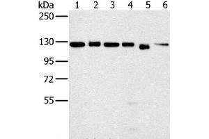 Western Blot analysis of 293T, K562, hela, 231, Jurkat and NIH/3T3 cell using MATR3 Polyclonal Antibody at dilution of 1:500 (MATR3 Antikörper)