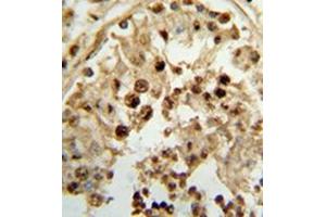 Immunohistochemistry analysis in formalin-fixed and paraffin-embedded human testis tissue reacted with 17-beta-HSD3 / HSD17B3 Antibody (Center) followed which was peroxidase conjugated to the secondary antibody, followed by DAB staining.