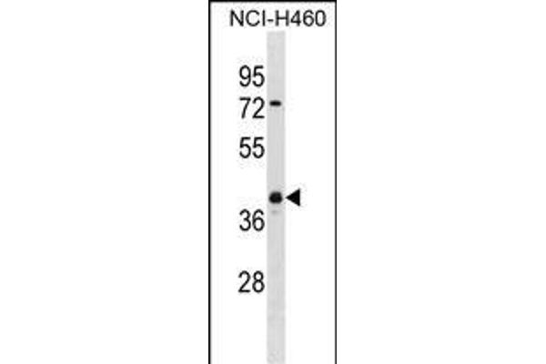 UCHL5 Antikörper  (AA 136-164)