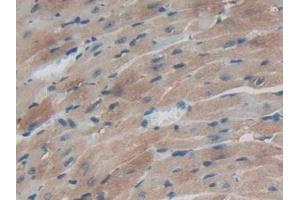 IHC-P analysis of Mouse Heart Tissue, with DAB staining. (TXNRD1 Antikörper  (AA 374-577))