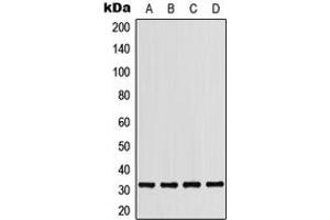 Western blot analysis of CD279 expression in THP1 (A), HepG2 (B), mouse liver (C), H9C2 (D) whole cell lysates. (PD-1 Antikörper  (Center))