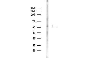 Western blot analysis of lysates from LoVo cells(heat-shock,45 min treatment), using RFIP2 Antibody at 1/1000 dilution.
