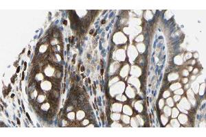 ABIN6278288 at 1/100 staining Rat colon tissue by IHC-P. (TMOD2 Antikörper  (N-Term))