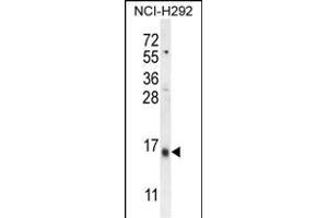 LY6G6C Antibody (C-term) (ABIN654496 and ABIN2844228) western blot analysis in NCI- cell line lysates (35 μg/lane).
