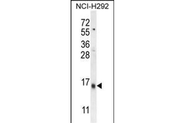 LY6G6C anticorps  (C-Term)